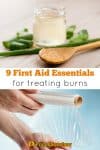 9 First Aid Kit essentials for treating burns