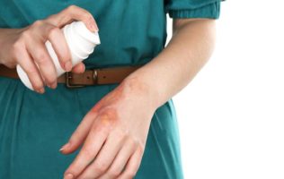 9 Things to Have in Your First Aid Kit for Treating Burns
