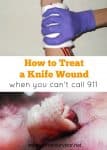 How to treat a knife wound when you can't call 911