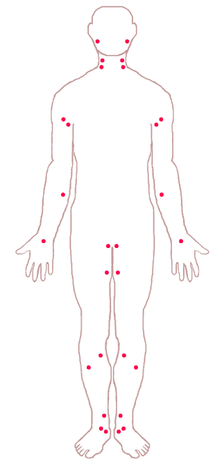 arterial pressure points for artery bleeding