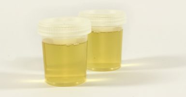 Drinking Urine for Survival – Is It Safe?
