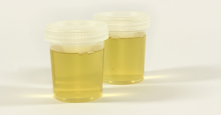 urine sample