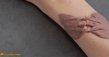 A Guide to Using Butterfly Bandages for First Aid (Store Bought & DIY Versions)