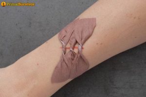 Multiple Bandages