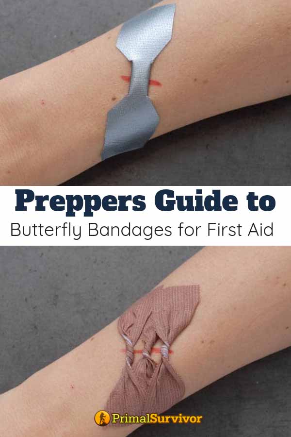 A Guide to Using Butterfly Bandages for First Aid (Store Bought & DIY
