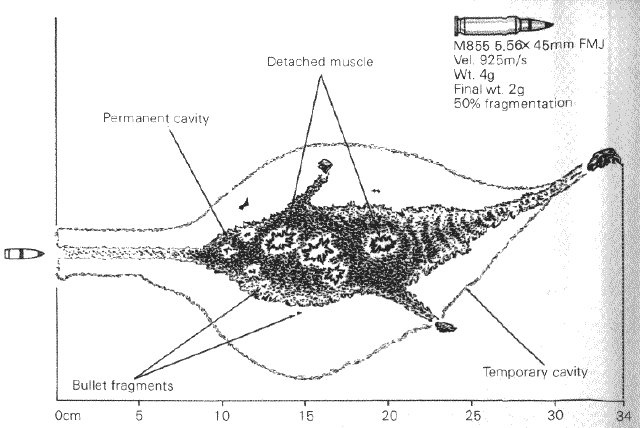 gunshot wound internal damage