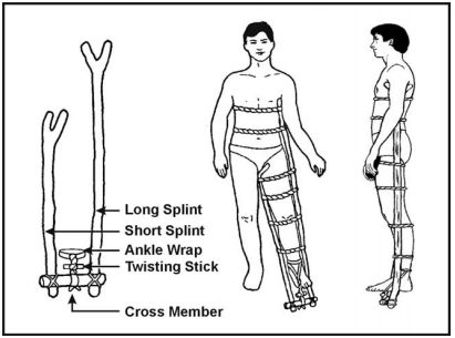 improvised traction splint