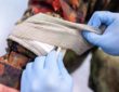 Israeli Bandage vs. Tourniquet: Which Is Better?